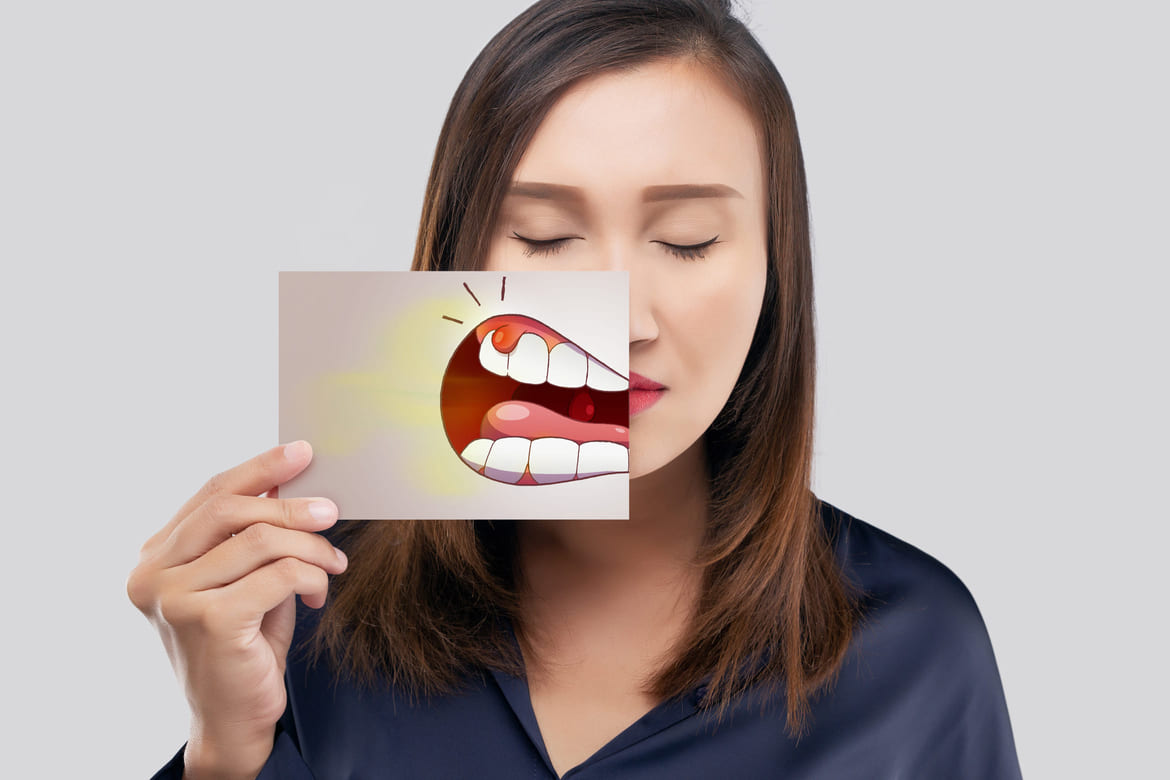 Gingivitt_herobilde_behandling Gingivitt tannkjøttsykdom